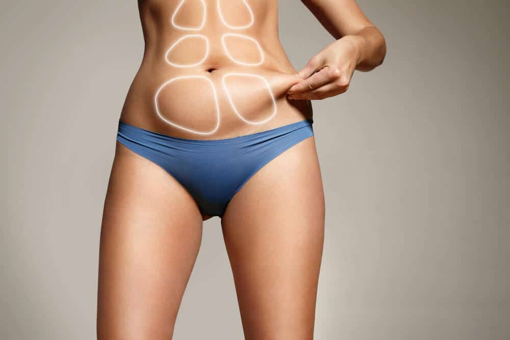 Peut-on faire un tatouage sur la cicatrice d’une abdominoplastie ?